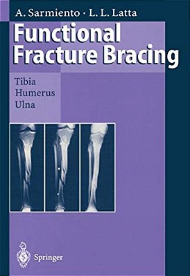 Functional Fracture Bracing: Tibia, Humerus, And Ulna-..