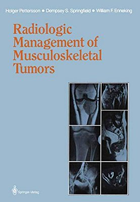 Radiologic Management Of Musculoskeletal Tumors-..