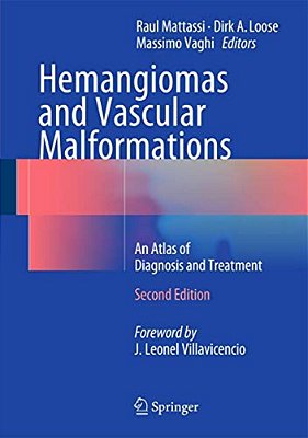 Hemangiomas And Vascular Malformations: An Atlas Of Diagnosis And Treatment-..