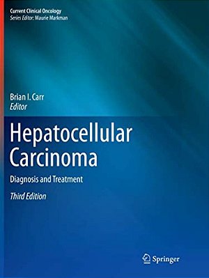 Hepatocellular Carcinoma: Diagnosis And Treatment-..