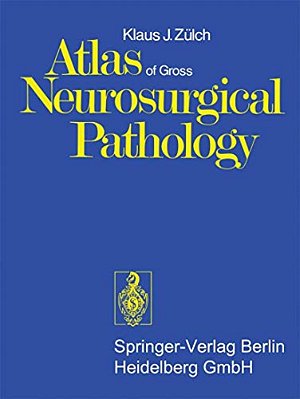 Atlas Of Gross Neurosurgical Pathology-..