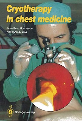 Cryotherapy In Chest Medicine-..