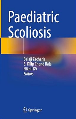 Paediatric Scoliosis-..