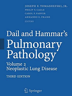 Dail And Hammar's Pulmonary Pathology: Volume II: Neoplastic Lung Disease-..
