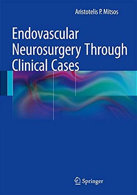 Endovascular Neurosurgery Through Clinical Cases-..