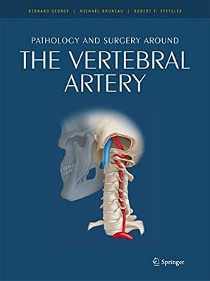 Pathology And Surgery Around The Vertebral Artery-..