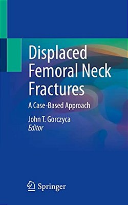 Displaced Femoral Neck Fractures: A Case-Based Approach-..