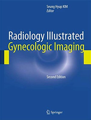 Radiology Illustrated: Gynecologic Imaging-..