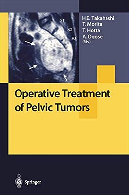 Operative Treatment Of Pelvic Tumors-..