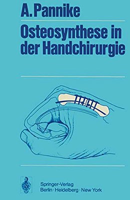 Osteosynthese In Der Handchirurgie-..