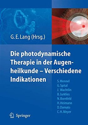 Photodynamische Therapie In Der Augenheilkunde-Verschiedene Indikationen-..