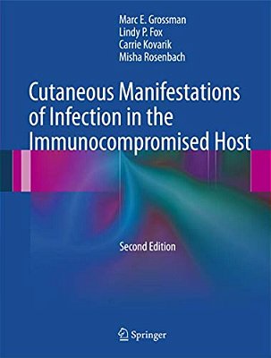 Cutaneous Manifestations Of Infection In The Immunocompromised Host-..
