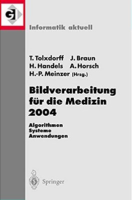 Bildverarbeitung Für Die Medizin 2004: Algorithmen - Systeme - Anwendungen-..