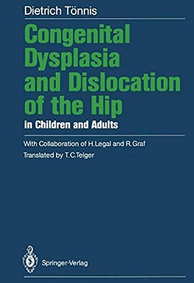 Congenital Dysplasia And Dislocation Of The Hip In Children And Adults-..