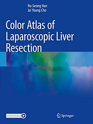 Color Atlas Of Laparoscopic Liver Resection-..