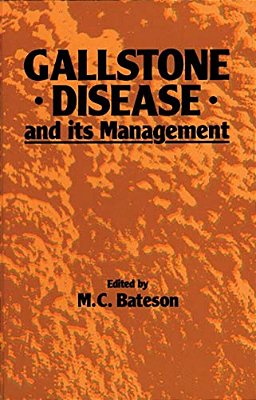 Gallstone Disease And Its Management-..