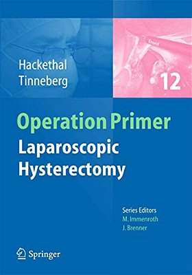 Laparoscopic Hysterectomy-..