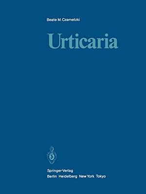 Urticaria-..