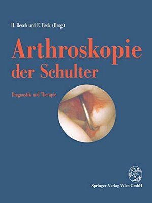 Arthroskopie Der Schulter: Diagnostik Und Therapie-..