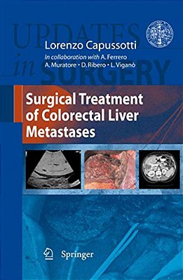 Surgical Treatment Of Colorectal Liver Metastases-..
