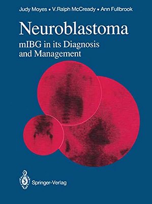 Neuroblastoma: Mibg In Its Diagnosis And Management-..
