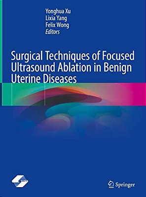 Surgical Techniques Of Focused Ultrasound Ablation In Benign Uterine Diseases-..