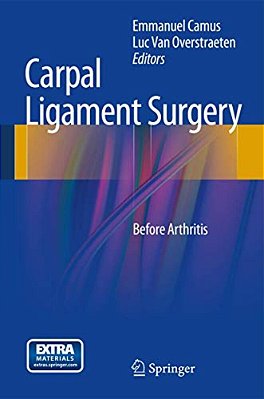 Carpal Ligament Surgery: Before Arthritis-..