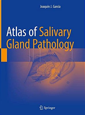 Atlas Of Salivary Gland Pathology-..
