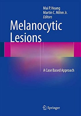 Melanocytic Lesions: A Case Based Approach-..