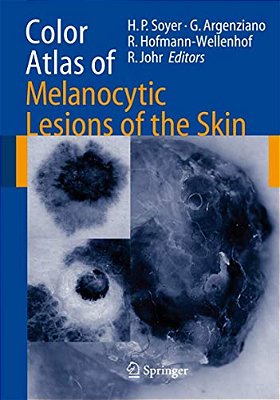 Color Atlas Of Melanocytic Lesions Of The Skin-..