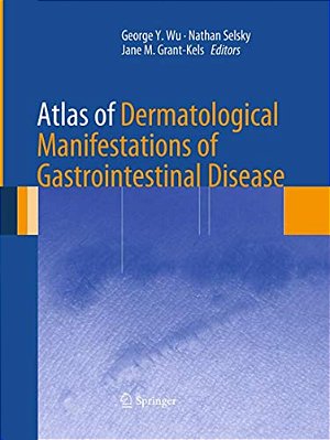 Atlas Of Dermatological Manifestations Of Gastrointestinal Disease-..