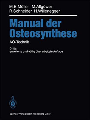 Manual Der Osteosynthese: Ao-Technik-..