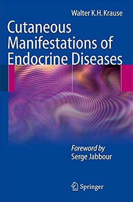 Cutaneous Manifestations Of Endocrine Diseases-..