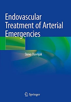 Endovascular Treatment Of Arterial Emergencies-..