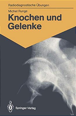 Knochen Und Gelenke: 170 Diagnostische Übungen Für Studenten Und Praktische Radiologen-..