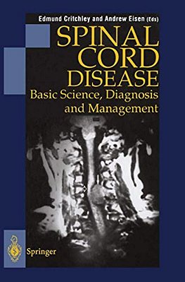 Spinal Cord Disease: Basic Science, Diagnosis And Management-..