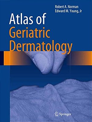 Atlas Of Geriatric Dermatology-..