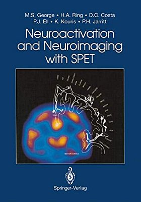 Neuroactivation And Neuroimaging With Spet-..
