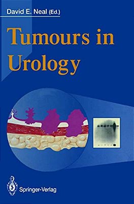 Tumours In Urology-..