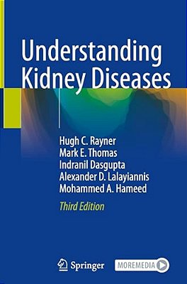Understanding Kidney Diseases-..