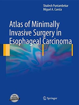 Atlas Of Minimally Invasive Surgery In Esophageal Carcinoma-..