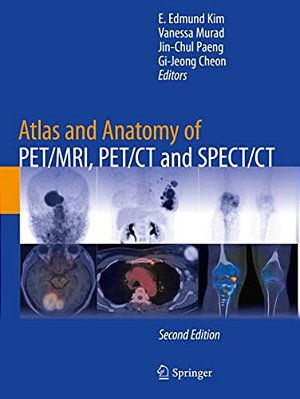 Atlas And Anatomy Of Pet/Mri, Pet/Ct And Spect/Ct-..