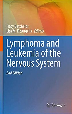 Lymphoma And Leukemia Of The Nervous System-..
