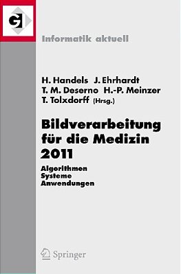 Bildverarbeitung Für Die Medizin 2011: Algorithmen - Systeme - Anwendungen Proceedings Des Workshops Vom 20. - 22. März 2011 In Lübeck-..