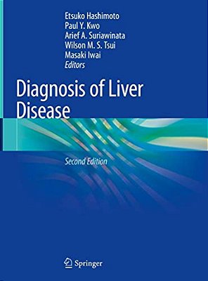 Diagnosis Of Liver Disease-..