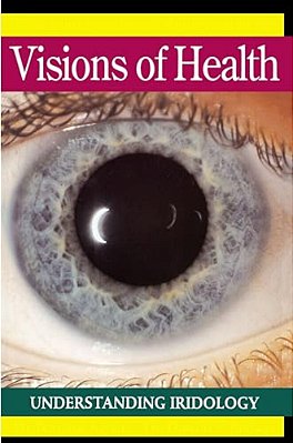 Visions Of Health: Understanding Iridology-..