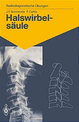 Halswirbelsäule: 60 Diagnostische Übungen Für Studenten Und Praktische Radiologen-..