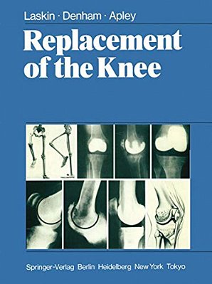 Replacement Of The Knee-..