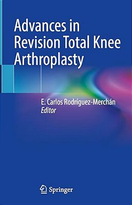 Advances In Revision Total Knee Arthroplasty-..