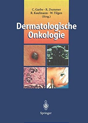 Dermatologische Onkologie-..